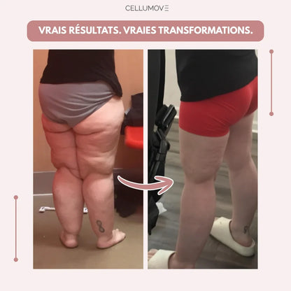 Legging 3D Cellumove – Dites adieu naturellement aux douleurs et gonflements du lipœdème